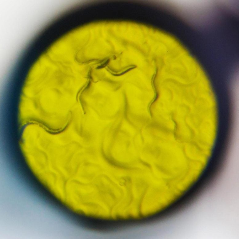 Nematode Worms Under the Microscope