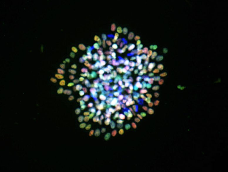 Nephron Progenitor Cells