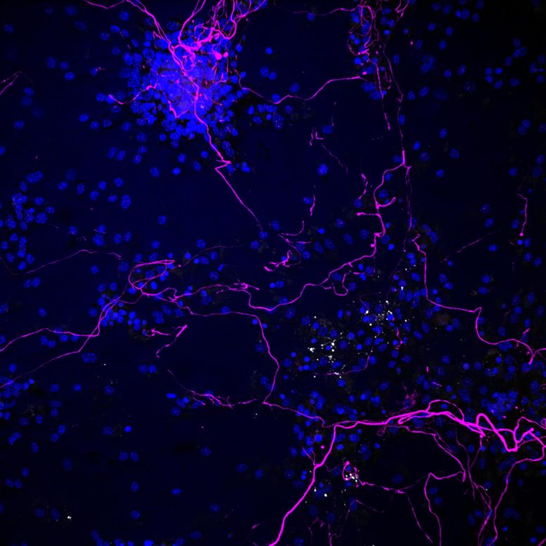 Nerve Fibers and Oligodendrocytes Treated With IL 12