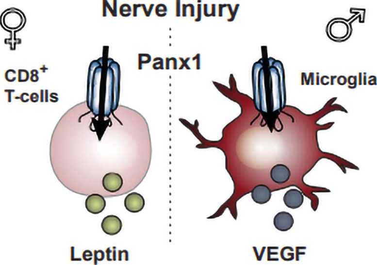 Nerve Injury Pain Graphic