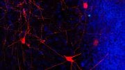 Network of the Neurons