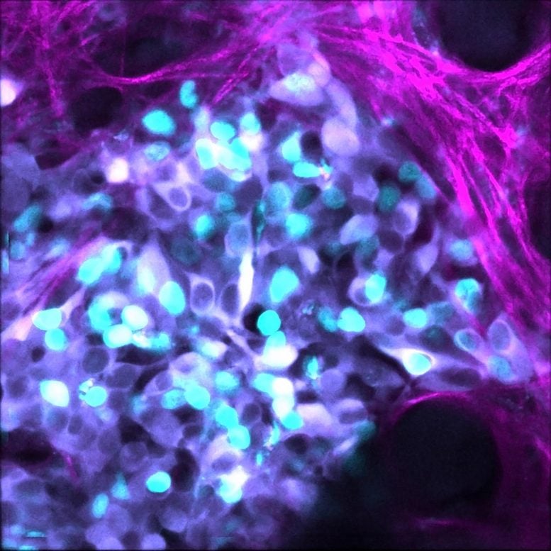 Neuroblastoma Cells