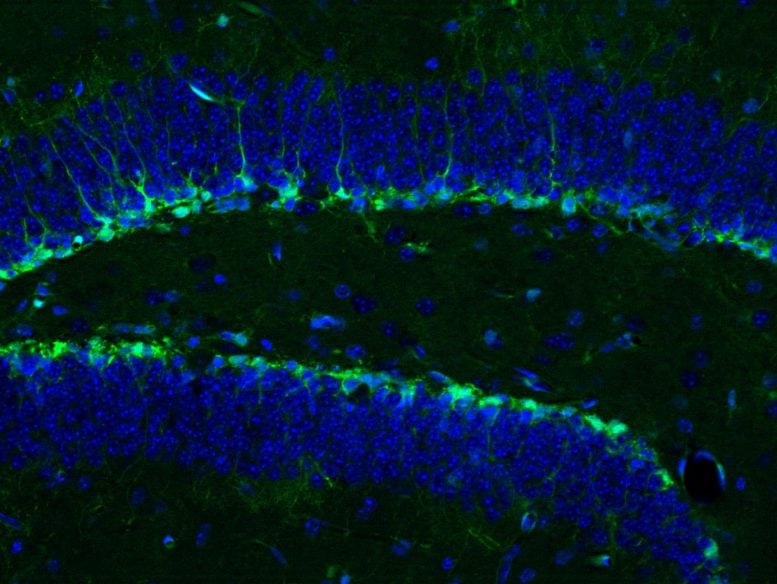 Neurogenesis Mouse Hippocampus
