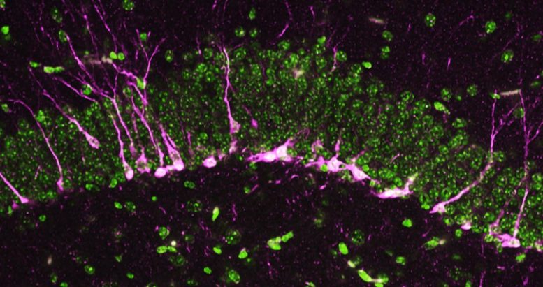 Neurogenesis in Normal Mouse Brain