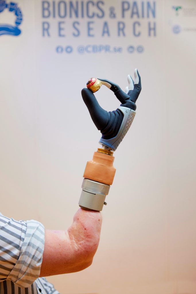 How a UTSA grad and Alt-Bionics are building a bionic hand