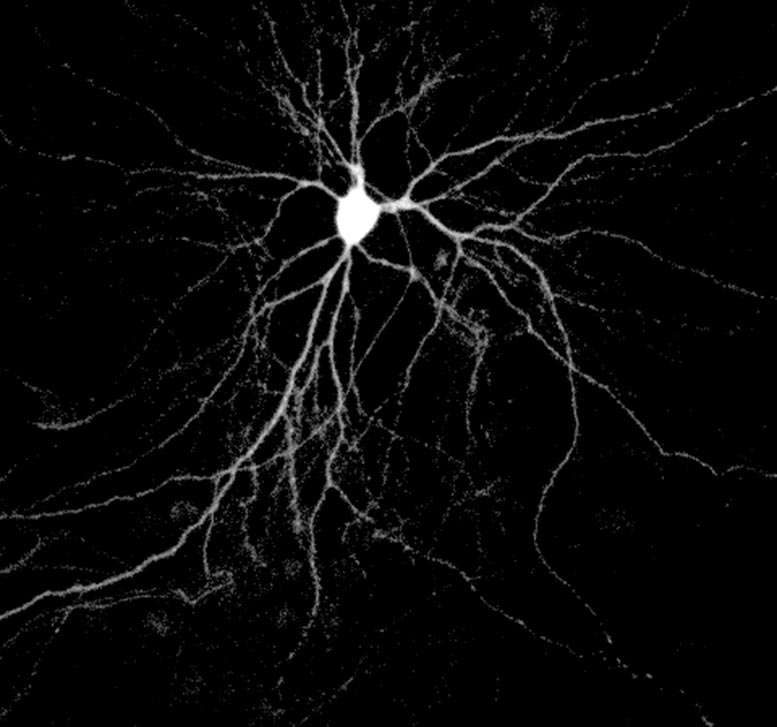 Neuron Expressing Human Tau Protein