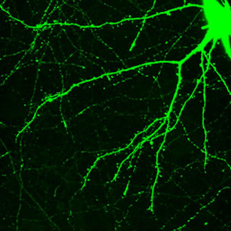 Neuronal Spines