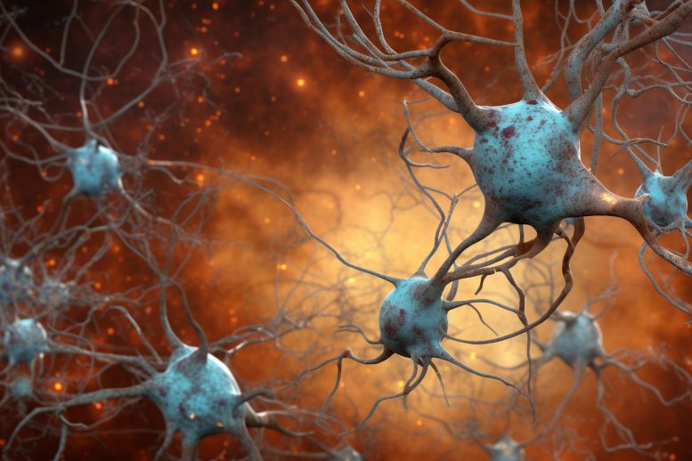 Neurons Alzheimer's Disease Art Concept