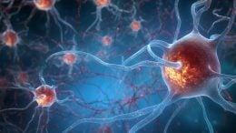Neurons Alzheimer's Disease Concept Art