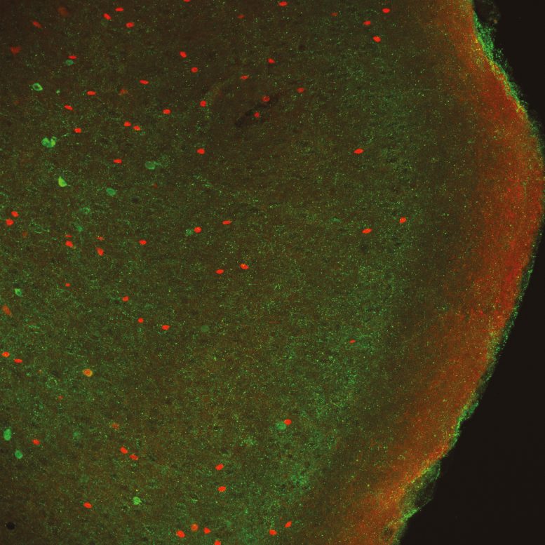 Neurons Captured Using a Fluorescent Microscope