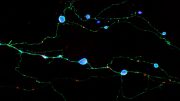 Neurons Expressing Mutant Prion Protein