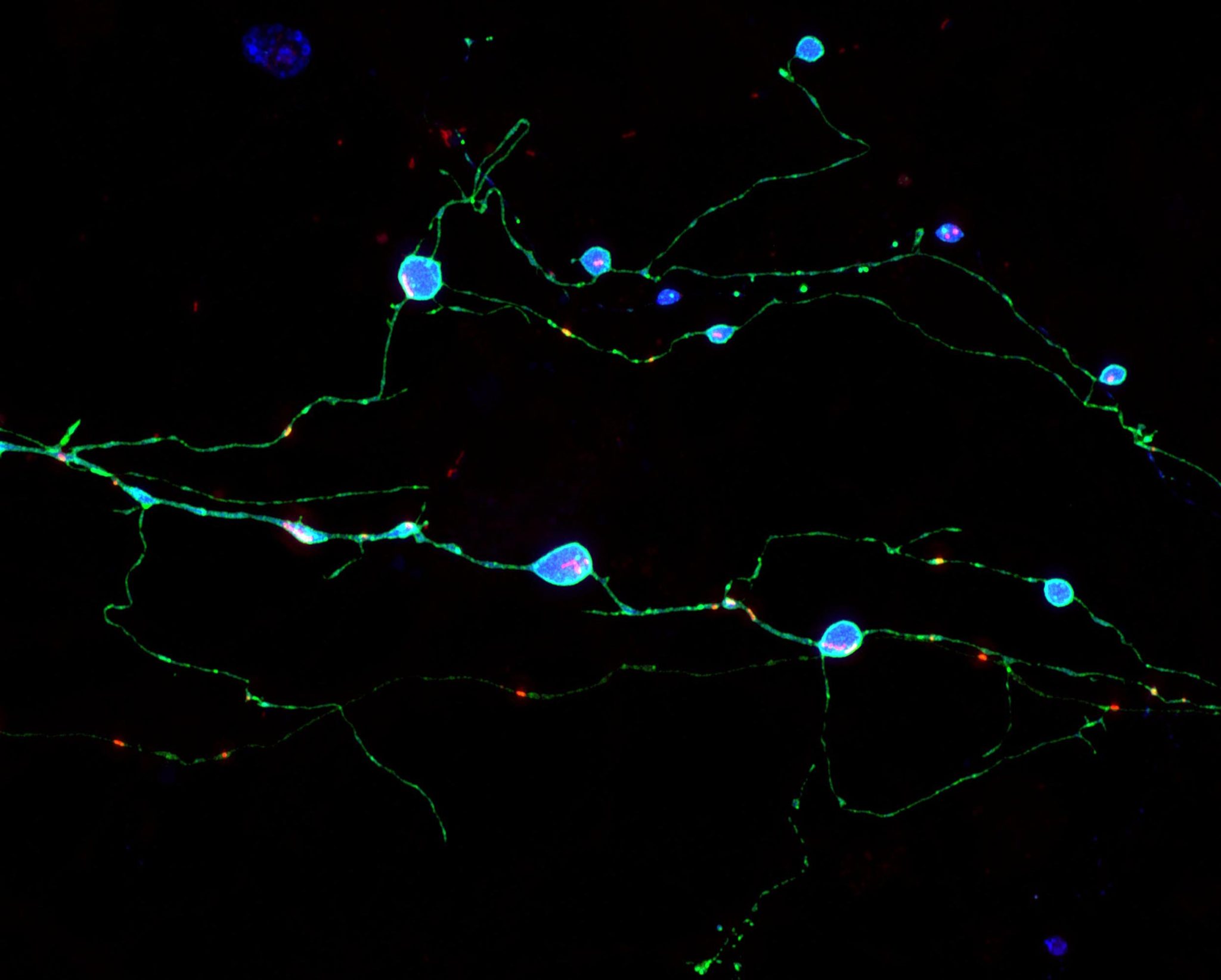 How Toxic Aggregates Form and Kill Brain Cells in Prion Diseases