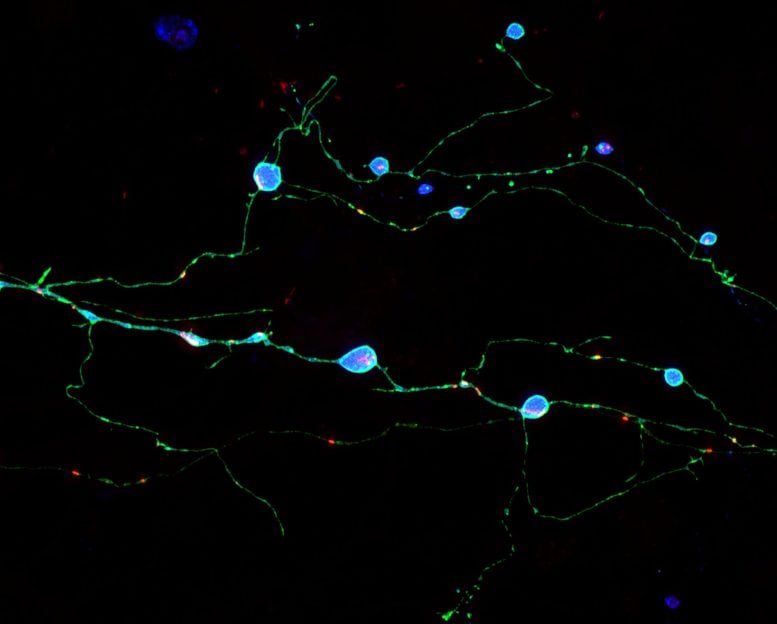 Neurons Expressing Mutant Prion Protein