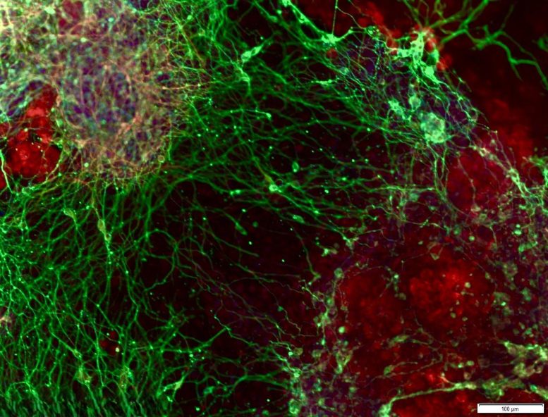 Neurons Grown From Stem Cells in the Lab Form an Interconnected Network