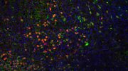 Neurons In Mouse Cortex Damaged By Prenatal Exposure To Alcohol