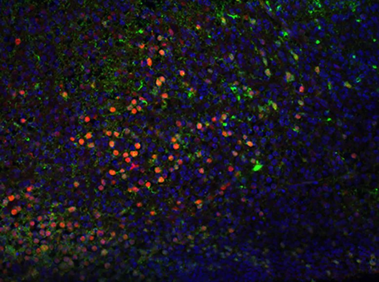Neurons In Mouse Cortex Damaged By Prenatal Exposure To Alcohol