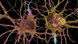 Neurons Parkinson's Disease