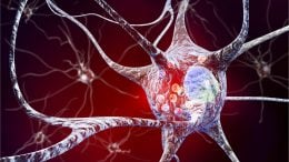 Neurons Parkinson's Lewy Body Disease