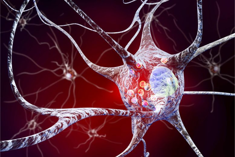 Neurons Parkinson's Lewy Body Disease