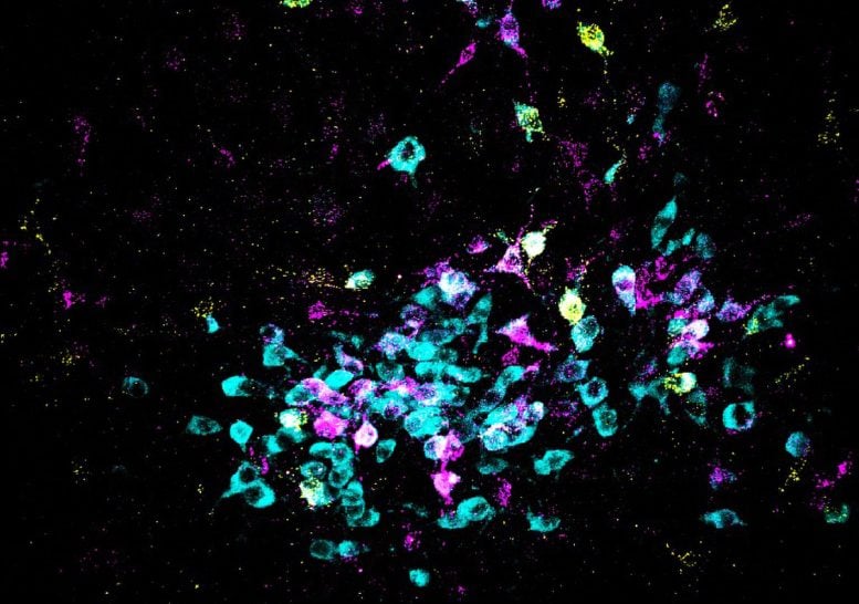 Neurons Shown in Cyan and Retrograde Tracers Shown in Yellow and Magenta