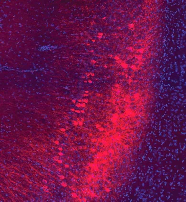 Neurons That Send Signals Between Amygdala and Hippocampus