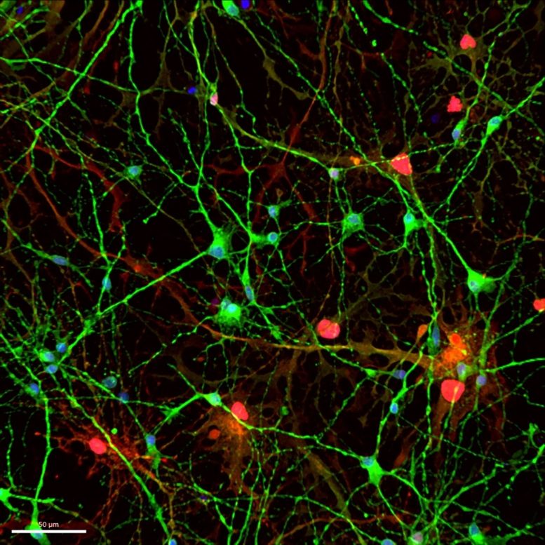 Neurons and Astrocytes Grown From Stem Cells
