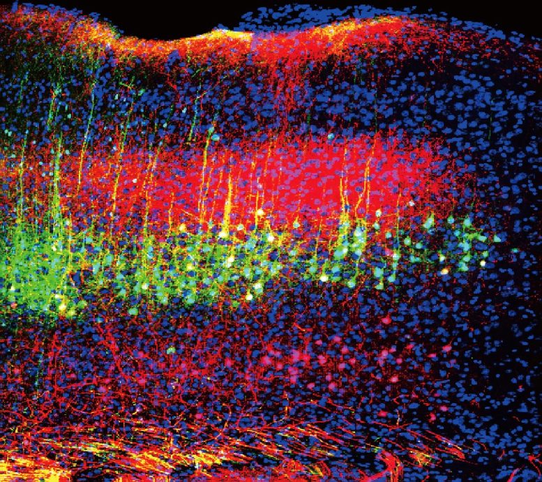 Neurons in Mouse Auditory Cortex