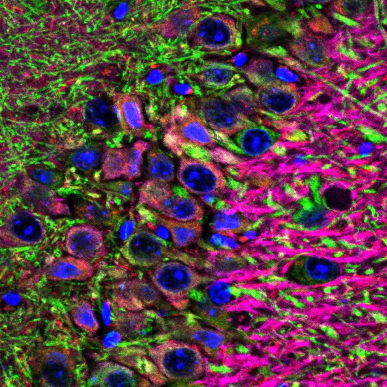 Neurons of the Hippocampus