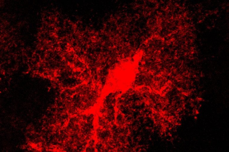 Neuroscientists Give Invisible Cells a New Look