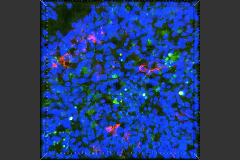 Neuroscientists Link APOE4 Gene to Alzheimer’s