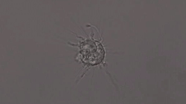 Neuroscientists Link Gene to Alzheimer’s