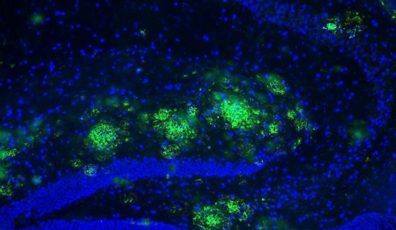 New Compound for Treatment of Alzheimer’s
