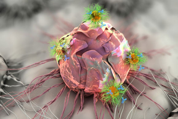 New Device Delivers Therapy to Tumor Sites