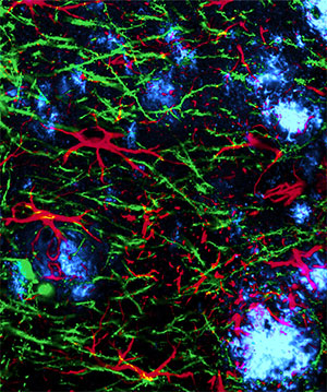 New Drug Restores Cells and Memories in Alzheimer’s Mouse Models
