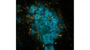 New Finding May Pave the Way for Better Diagnosis of Neurodegenerative Diseases