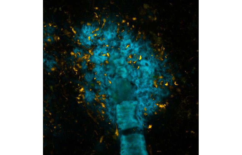 New Finding May Pave the Way for Better Diagnosis of Neurodegenerative Diseases