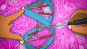 New Gene Therapy Technique May Help Prevent Cancer Metastasis