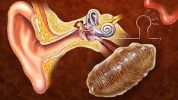 New Genetic Modification May Prevent Hearing Loss