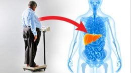 New Link between Obesity and a Common Liver Disease Discovered