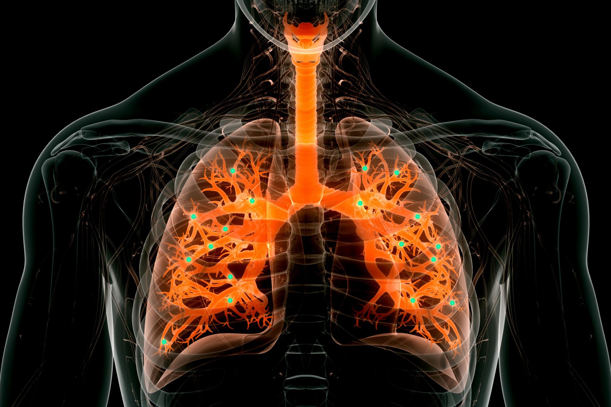 New Nanoparticles Can Perform Gene Editing in the Lungs