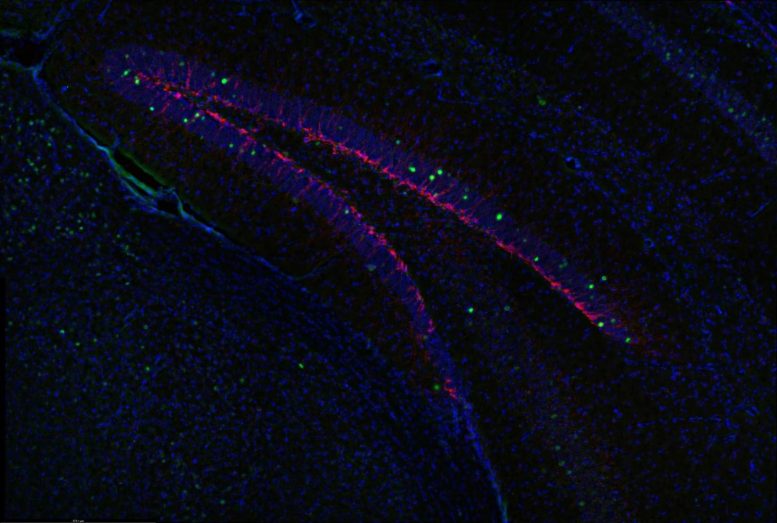 New Neuron Growth in Hippocampus After SGK1 Inhibition