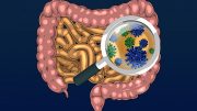 New Research Reveals How Altered Gut Microbes Cause Obesity