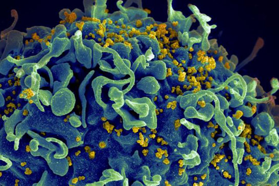 New Research Yields Insight Into Generating Antibodies That Target Different Strains of HIV
