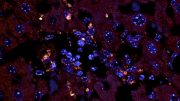 New Study Details How Gut Bacteria Drive Autoimmune Disease