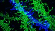 New Tissue-Expansion Technique Provides High-resolution imaging at a Fraction of the Cost