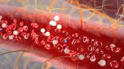 Newly Developed Microfluidic Device Isolates Plasma Cells from Blood