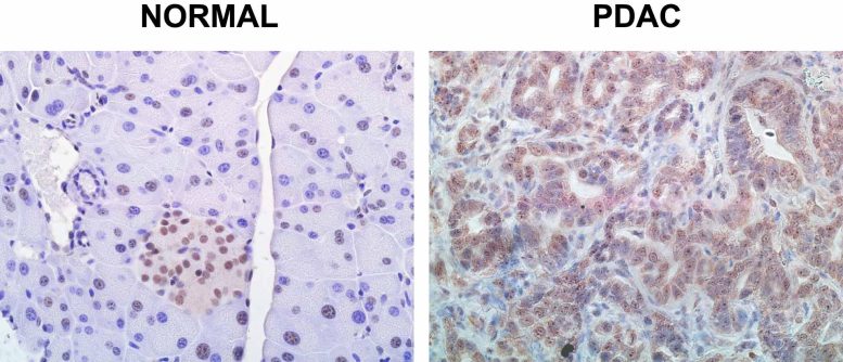 Normal PDAC Pancreas Cells