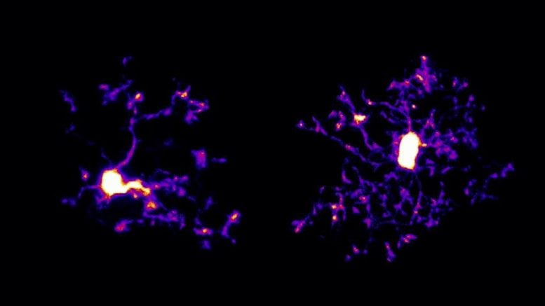 Normal and SRGAP2 Deficient Microglia Comparison