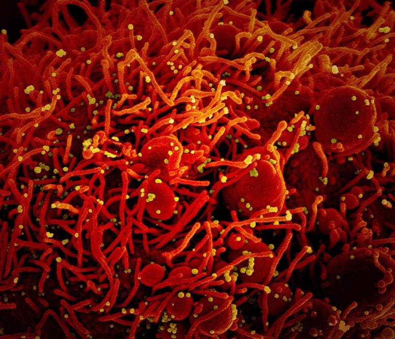 Novel Coronavirus SARS-CoV-2 Colorized Scanning Electron Micrograph