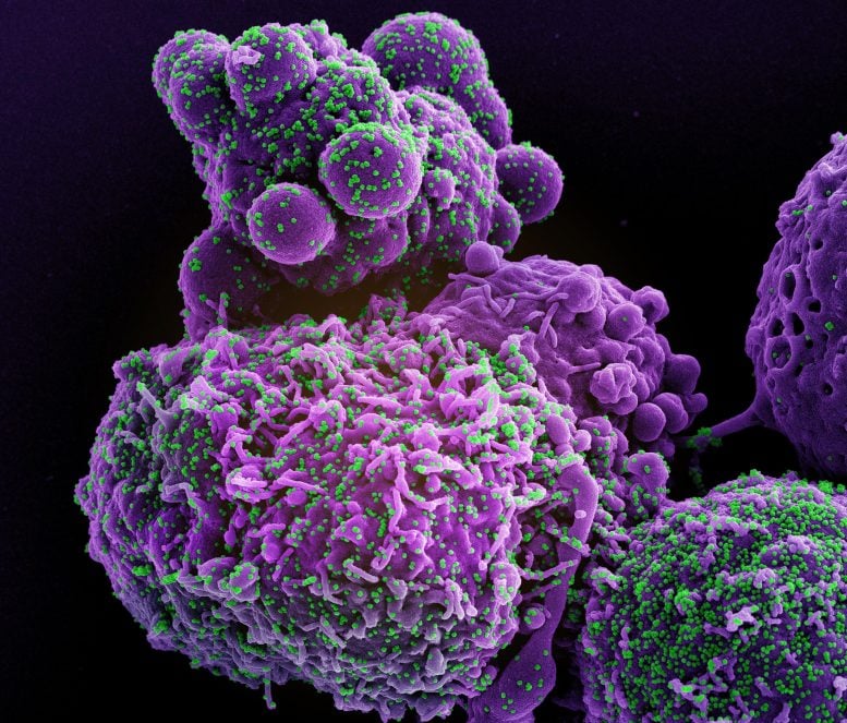 Novel Coronavirus SARS CoV 2 (Omicron) Purple Green